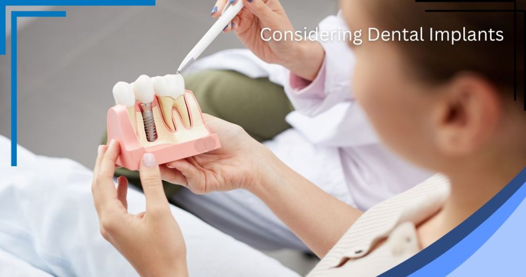 Dental Implants - Post 2